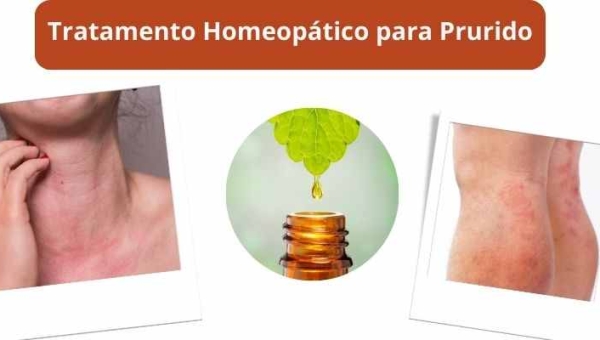 Tratamento Homeopático para Prurido